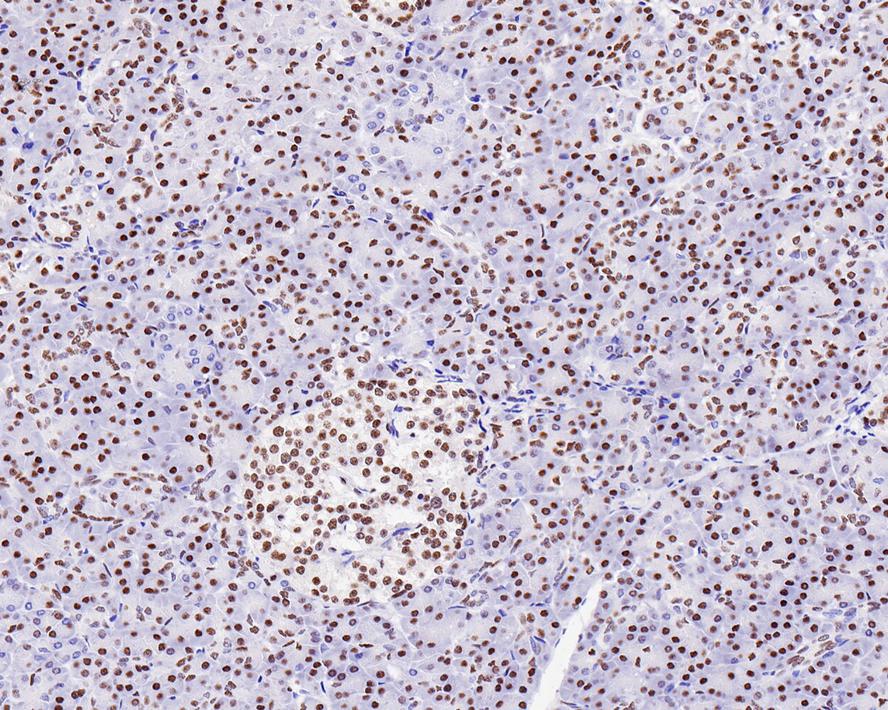 Immunohistochemical analysis of paraffin-embedded human pancreas tissue using anti-HDAC8 antibody. The section was pre-treated using heat mediated antigen retrieval with Tris-EDTA buffer (pH 8.0-8.4) for 20 minutes.The tissues were blocked in 5% BSA for 30 minutes at room temperature, washed with ddH2O and PBS, and then probed with the primary antibody (ET1701-12, 1/50) for 30 minutes at room temperature. The detection was performed using an HRP conjugated compact polymer system. DAB was used as the chromogen. Tissues were counterstained with hematoxylin and mounted with DPX.