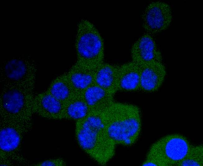 ICC staining TrkA+B+C in N2A cells (green). The nuclear counter stain is DAPI (blue). Cells were fixed in paraformaldehyde, permeabilised with 0.25% Triton X100/PBS.