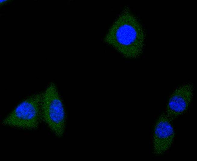 ICC staining TrkA+B+C in SH-SY-5Y cells (green). The nuclear counter stain is DAPI (blue). Cells were fixed in paraformaldehyde, permeabilised with 0.25% Triton X100/PBS.