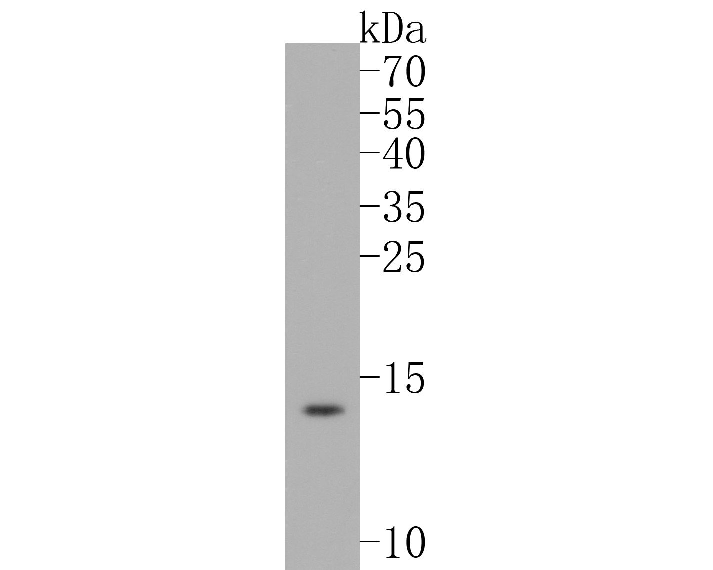 Western blot analysis of Sumo 2+3 on SW480 cell lysates. Proteins were transferred to a PVDF membrane and blocked with 5% BSA in PBS for 1 hour at room temperature. The primary antibody (ET1701-17, 1/500) was used in 5% BSA at room temperature for 2 hours. Goat Anti-Rabbit IgG - HRP Secondary Antibody (HA1001) at 1:5,000 dilution was used for 1 hour at room temperature.