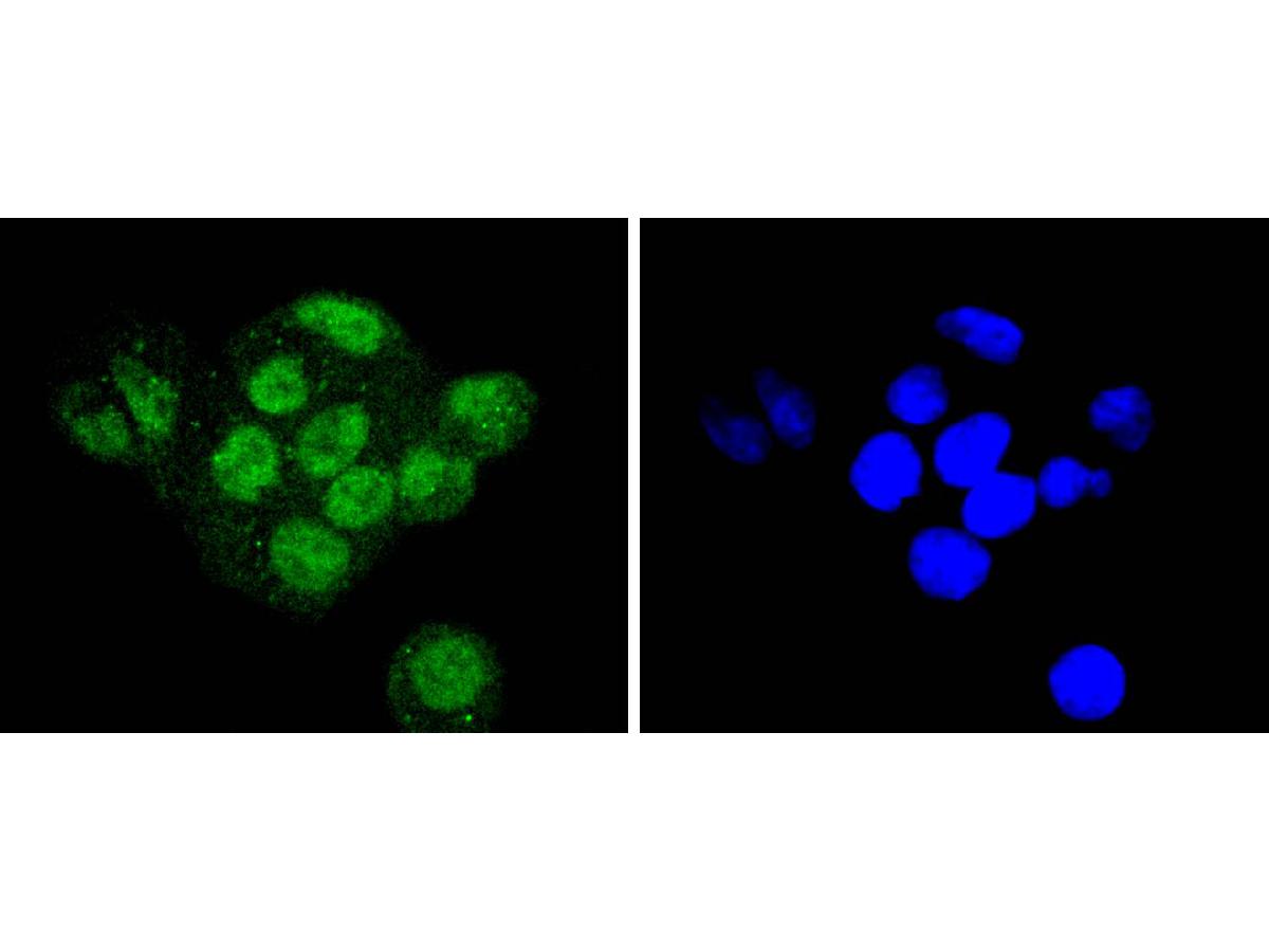 ICC staining of Sumo 2+3 in Hela cells (green). Formalin fixed cells were permeabilized with 0.1% Triton X-100 in TBS for 10 minutes at room temperature and blocked with 1% Blocker BSA for 15 minutes at room temperature. Cells were probed with the primary antibody (ET1701-17, 1/50) for 1 hour at room temperature, washed with PBS. Alexa Fluor®488 Goat anti-Rabbit IgG was used as the secondary antibody at 1/1,000 dilution. The nuclear counter stain is DAPI (blue).