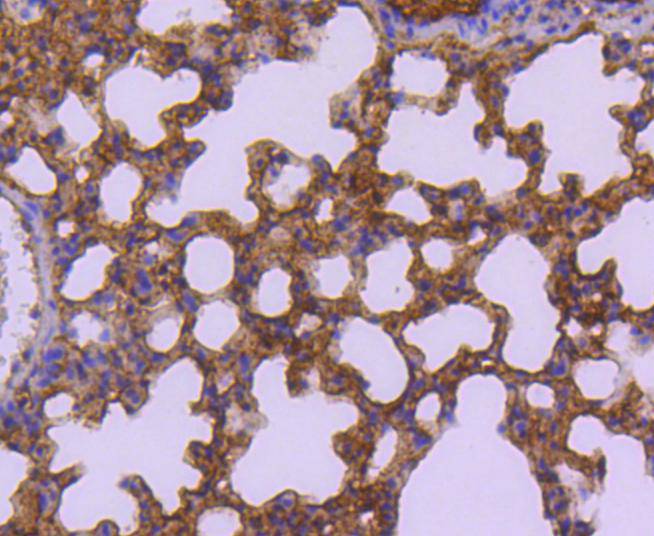 Immunohistochemical analysis of paraffin-embedded mouse lung tissue using anti-Sumo 2+3 antibody. The section was pre-treated using heat mediated antigen retrieval with Tris-EDTA buffer (pH 8.0-8.4) for 20 minutes.The tissues were blocked in 5% BSA for 30 minutes at room temperature, washed with ddH2O and PBS, and then probed with the primary antibody (ET1701-17, 1/50) for 30 minutes at room temperature. The detection was performed using an HRP conjugated compact polymer system. DAB was used as the chromogen. Tissues were counterstained with hematoxylin and mounted with DPX.