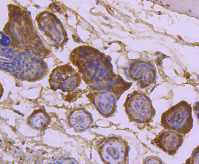 Immunohistochemical analysis of paraffin-embedded mouse skin tissue using anti-Sumo 2+3 antibody. The section was pre-treated using heat mediated antigen retrieval with Tris-EDTA buffer (pH 8.0-8.4) for 20 minutes.The tissues were blocked in 5% BSA for 30 minutes at room temperature, washed with ddH2O and PBS, and then probed with the primary antibody (ET1701-17, 1/50) for 30 minutes at room temperature. The detection was performed using an HRP conjugated compact polymer system. DAB was used as the chromogen. Tissues were counterstained with hematoxylin and mounted with DPX.
