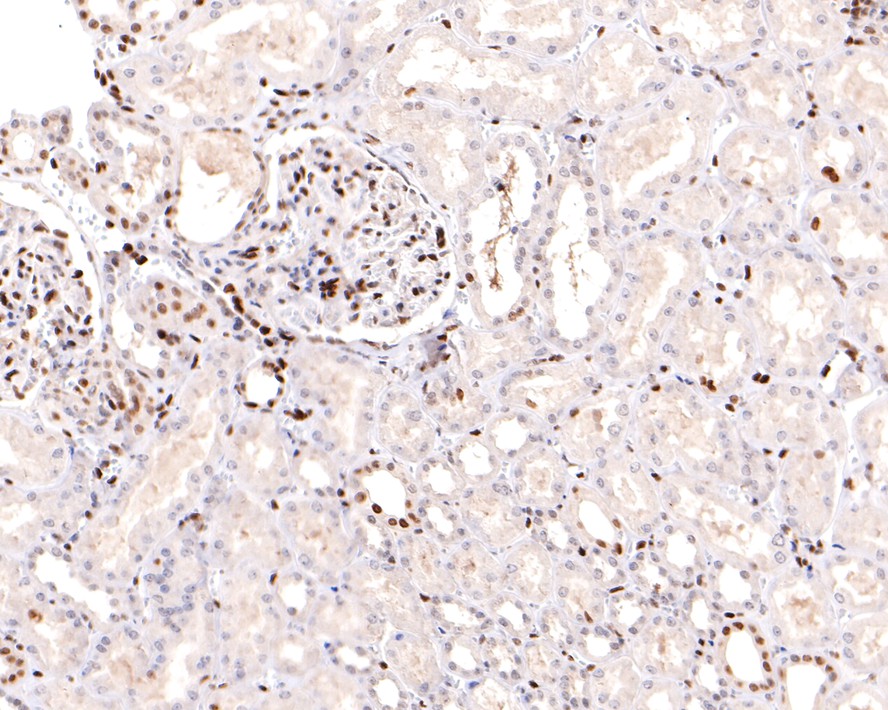 Immunohistochemical analysis of paraffin-embedded human kidney tissue with Rabbit anti-Sumo 2+3 antibody (ET1701-17) at 1/400 dilution.<br />
<br />
The section was pre-treated using heat mediated antigen retrieval with sodium citrate buffer (pH 6.0) for 2 minutes. The tissues were blocked in 1% BSA for 20 minutes at room temperature, washed with ddH2O and PBS, and then probed with the primary antibody (ET1701-17) at 1/400 dilution for 1 hour at room temperature. The detection was performed using an HRP conjugated compact polymer system. DAB was used as the chromogen. Tissues were counterstained with hematoxylin and mounted with DPX.