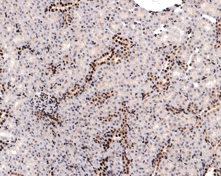 Immunohistochemical analysis of paraffin-embedded mouse kidney tissue with Rabbit anti-Sumo 2+3 antibody (ET1701-17) at 1/400 dilution.<br />
<br />
The section was pre-treated using heat mediated antigen retrieval with sodium citrate buffer (pH 6.0) for 2 minutes. The tissues were blocked in 1% BSA for 20 minutes at room temperature, washed with ddH2O and PBS, and then probed with the primary antibody (ET1701-17) at 1/400 dilution for 1 hour at room temperature. The detection was performed using an HRP conjugated compact polymer system. DAB was used as the chromogen. Tissues were counterstained with hematoxylin and mounted with DPX.