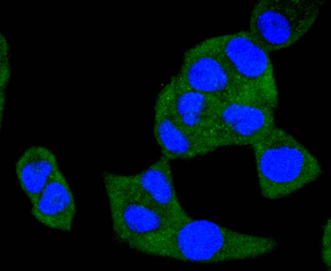 ICC staining of A-RAF in A431 cells (green). Formalin fixed cells were permeabilized with 0.1% Triton X-100 in TBS for 10 minutes at room temperature and blocked with 1% Blocker BSA for 15 minutes at room temperature. Cells were probed with the primary antibody (ET1701-18, 1/50) for 1 hour at room temperature, washed with PBS. Alexa Fluor®488 Goat anti-Rabbit IgG was used as the secondary antibody at 1/1,000 dilution. The nuclear counter stain is DAPI (blue).