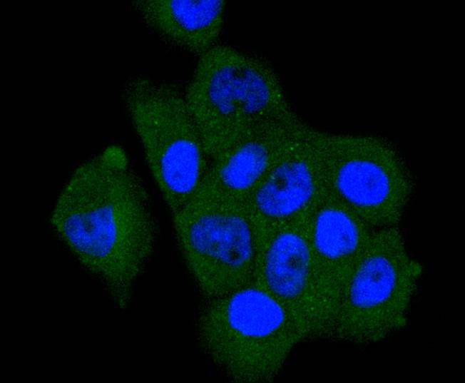 ICC staining of A-RAF in NIH/3T3 cells (green). Formalin fixed cells were permeabilized with 0.1% Triton X-100 in TBS for 10 minutes at room temperature and blocked with 1% Blocker BSA for 15 minutes at room temperature. Cells were probed with the primary antibody (ET1701-18, 1/50) for 1 hour at room temperature, washed with PBS. Alexa Fluor®488 Goat anti-Rabbit IgG was used as the secondary antibody at 1/1,000 dilution. The nuclear counter stain is DAPI (blue).