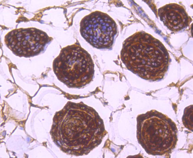 Immunohistochemical analysis of paraffin-embedded mouse skin tissue using anti-14-3-3 antibody. The section was pre-treated using heat mediated antigen retrieval with Tris-EDTA buffer (pH 8.0-8.4) for 20 minutes.The tissues were blocked in 5% BSA for 30 minutes at room temperature, washed with ddH2O and PBS, and then probed with the primary antibody (ET1701-2, 1/50) for 30 minutes at room temperature. The detection was performed using an HRP conjugated compact polymer system. DAB was used as the chromogen. Tissues were counterstained with hematoxylin and mounted with DPX.
