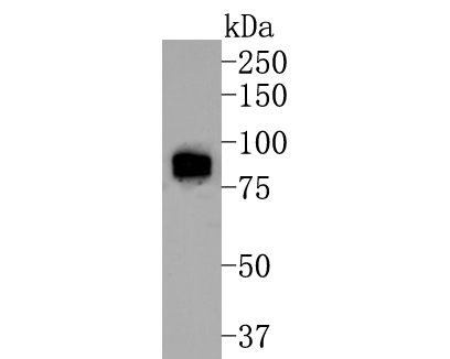 Western blot analysis of Phospho-B Raf(T401) on mouse testis tissue lysates. Proteins were transferred to a PVDF membrane and blocked with 5% BSA in PBS for 1 hour at room temperature. The primary antibody (ET1701-20, 1/500) was used in 5% BSA at room temperature for 2 hours. Goat Anti-Rabbit IgG - HRP Secondary Antibody (HA1001) at 1:200,000 dilution was used for 1 hour at room temperature.