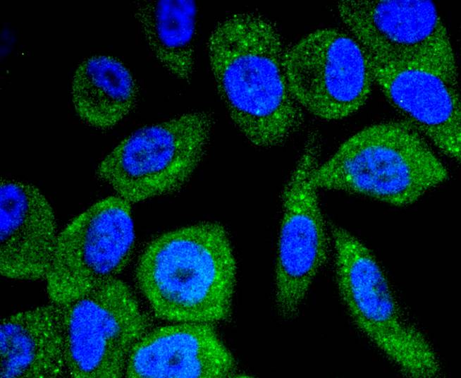 ICC staining of Phospho-B Raf(T401) in PC-3M cells (green). Formalin fixed cells were permeabilized with 0.1% Triton X-100 in TBS for 10 minutes at room temperature and blocked with 10% negative goat serum for 15 minutes at room temperature. Cells were probed with the primary antibody (ET1701-20, 1/50) for 1 hour at room temperature, washed with PBS. Alexa Fluor®488 conjugate-Goat anti-Rabbit IgG was used as the secondary antibody at 1/1,000 dilution. The nuclear counter stain is DAPI (blue).