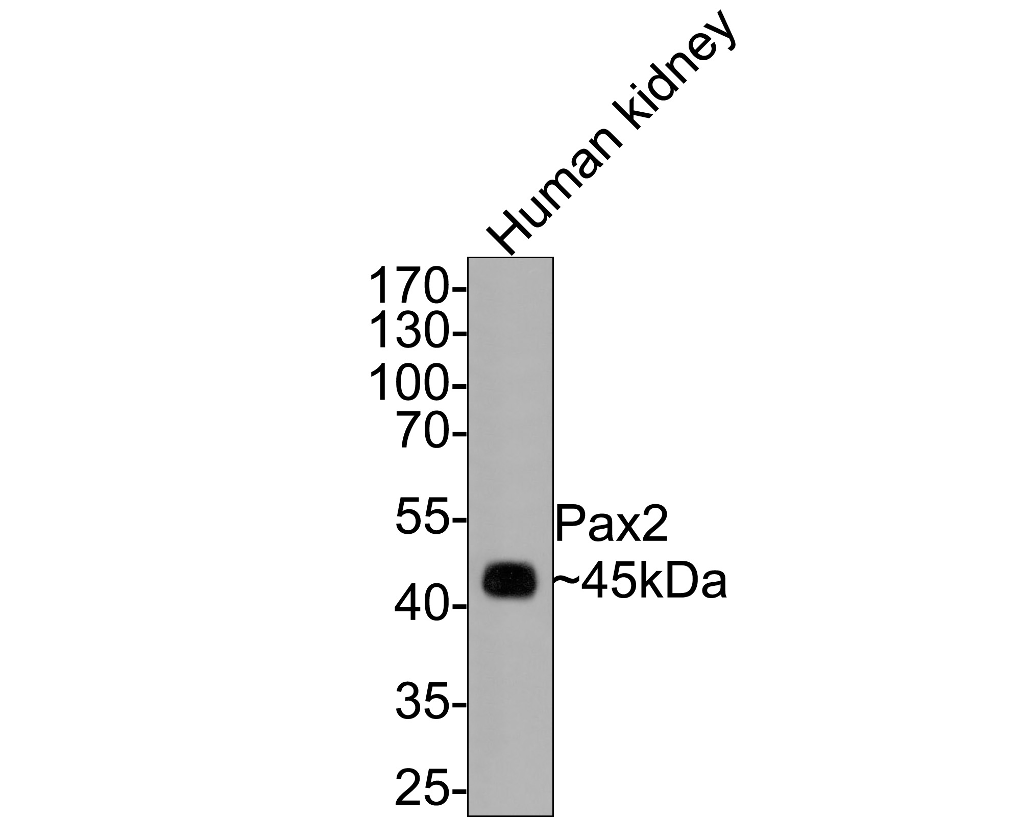 Western blot analysis of Pax2 on human kidney tissue lysates with Rabbit anti-Pax2 antibody (ET1701-23) at 1/500 dilution.<br />
<br />
Lysates/proteins at 20 µg/Lane.<br />
<br />
Predicted band size: 45 kDa<br />
Observed band size: 45 kDa<br />
<br />
Exposure time: 2 minutes;<br />
<br />
10% SDS-PAGE gel.<br />
<br />
Proteins were transferred to a PVDF membrane and blocked with 5% NFDM/TBST for 1 hour at room temperature. The primary antibody (ET1701-23) at 1/500 dilution was used in 5% NFDM/TBST at room temperature for 2 hours. Goat Anti-Rabbit IgG - HRP Secondary Antibody (HA1001) at 1:300,000 dilution was used for 1 hour at room temperature.