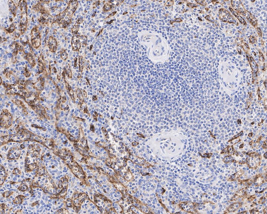 ICC staining of CD36 in SH-SY5Y cells (green). Formalin fixed cells were permeabilized with 0.1% Triton X-100 in TBS for 10 minutes at room temperature and blocked with 1% Blocker BSA for 15 minutes at room temperature. Cells were probed with the primary antibody (ET1701-24, 1/50) for 1 hour at room temperature, washed with PBS. Alexa Fluor®488 Goat anti-Rabbit IgG was used as the secondary antibody at 1/1,000 dilution. The nuclear counter stain is DAPI (blue).