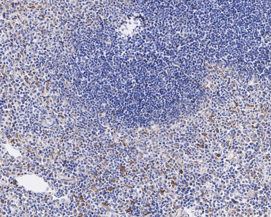 Immunohistochemical analysis of paraffin-embedded human spleen tissue using anti-CD36 antibody. The section was pre-treated using heat mediated antigen retrieval with Tris-EDTA buffer (pH 8.0-8.4) for 20 minutes.The tissues were blocked in 5% BSA for 30 minutes at room temperature, washed with ddH2O and PBS, and then probed with the primary antibody (ET1701-24, 1/50) for 30 minutes at room temperature. The detection was performed using an HRP conjugated compact polymer system. DAB was used as the chromogen. Tissues were counterstained with hematoxylin and mounted with DPX.