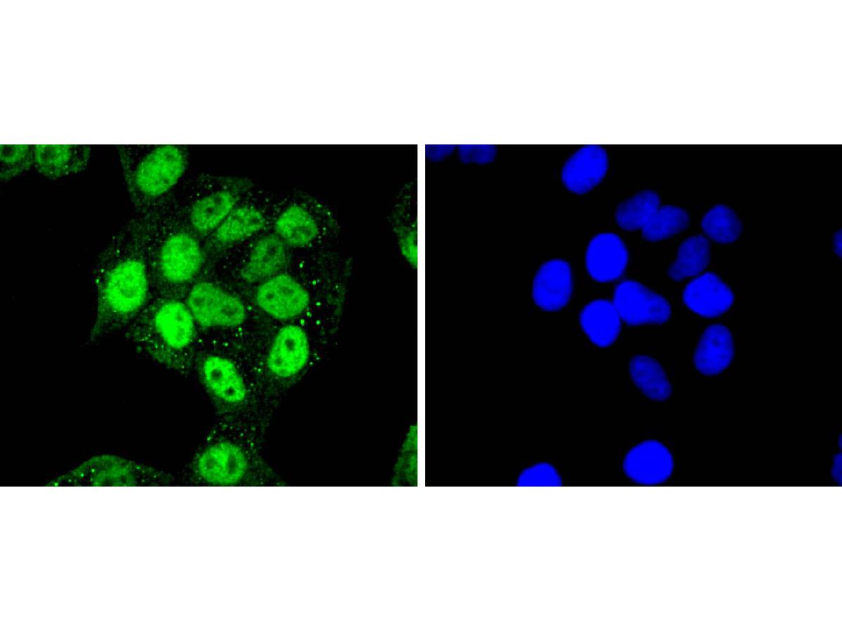 ICC staining of Cdk7 in Hela cells (green). Formalin fixed cells were permeabilized with 0.1% Triton X-100 in TBS for 10 minutes at room temperature and blocked with 1% Blocker BSA for 15 minutes at room temperature. Cells were probed with the primary antibody (ET1701-25, 1/50) for 1 hour at room temperature, washed with PBS. Alexa Fluor®488 Goat anti-Rabbit IgG was used as the secondary antibody at 1/1,000 dilution. The nuclear counter stain is DAPI (blue).
