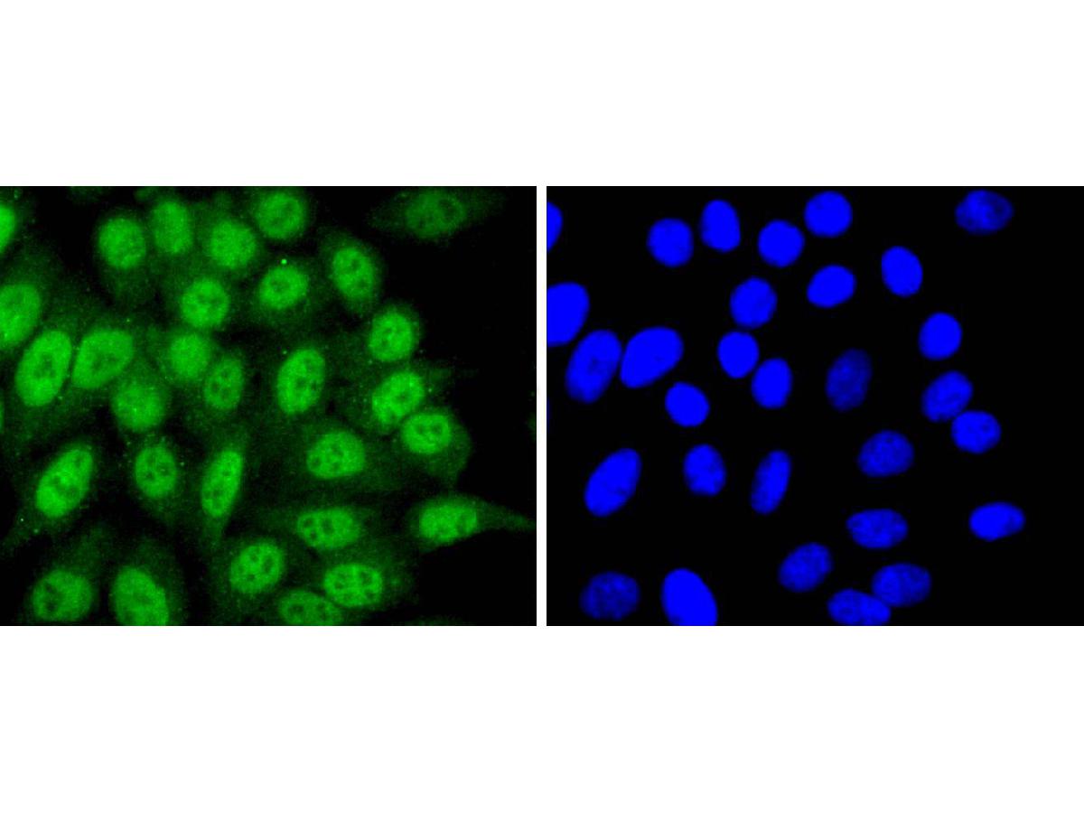 ICC staining of Cdk7 in HepG2 cells (green). Formalin fixed cells were permeabilized with 0.1% Triton X-100 in TBS for 10 minutes at room temperature and blocked with 1% Blocker BSA for 15 minutes at room temperature. Cells were probed with the primary antibody (ET1701-25, 1/50) for 1 hour at room temperature, washed with PBS. Alexa Fluor®488 Goat anti-Rabbit IgG was used as the secondary antibody at 1/1,000 dilution. The nuclear counter stain is DAPI (blue).
