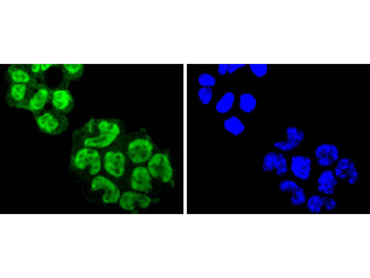 ICC staining EIF2C3 in NCCIT cells (green). The nuclear counter stain is DAPI (blue). Cells were fixed in paraformaldehyde, permeabilised with 0.25% Triton X100/PBS.