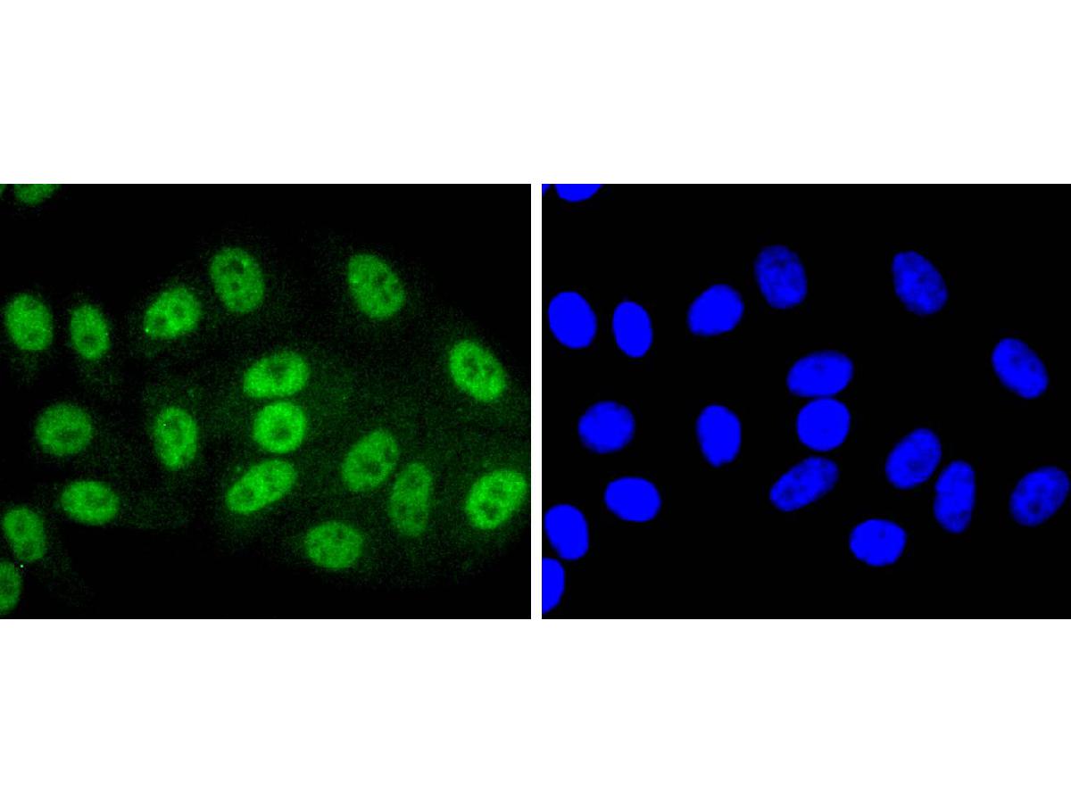ICC staining of Phospho-SIRT1(T530) in HepG2 cells (green). Formalin fixed cells were permeabilized with 0.1% Triton X-100 in TBS for 10 minutes at room temperature and blocked with 1% Blocker BSA for 15 minutes at room temperature. Cells were probed with the primary antibody (ET1701-27, 1/50) for 1 hour at room temperature, washed with PBS. Alexa Fluor®488 Goat anti-Rabbit IgG was used as the secondary antibody at 1/1,000 dilution. The nuclear counter stain is DAPI (blue).