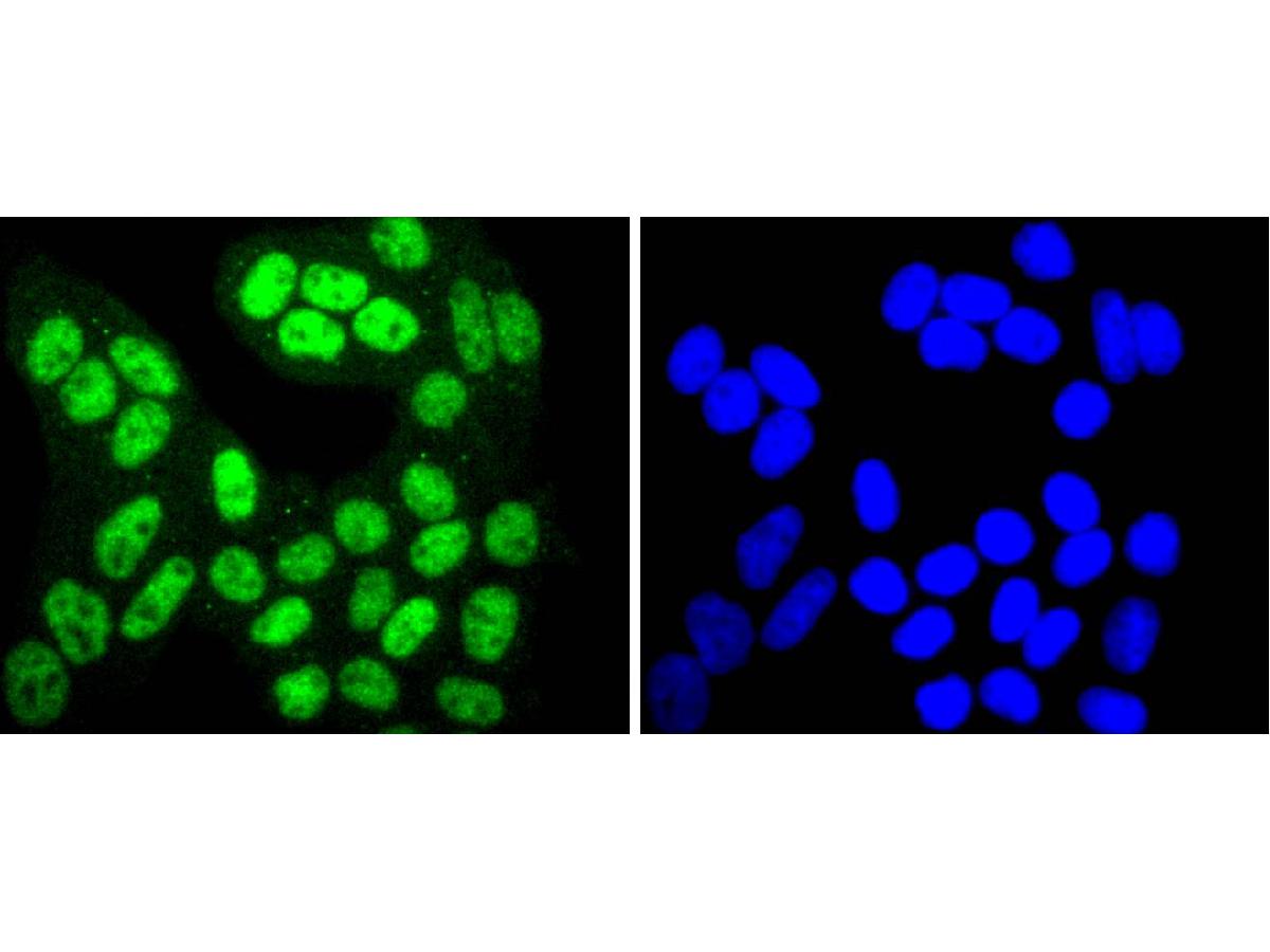 ICC staining of Phospho-SIRT1(T530) in Hela cells (green). Formalin fixed cells were permeabilized with 0.1% Triton X-100 in TBS for 10 minutes at room temperature and blocked with 1% Blocker BSA for 15 minutes at room temperature. Cells were probed with the primary antibody (ET1701-27, 1/50) for 1 hour at room temperature, washed with PBS. Alexa Fluor®488 Goat anti-Rabbit IgG was used as the secondary antibody at 1/1,000 dilution. The nuclear counter stain is DAPI (blue).
