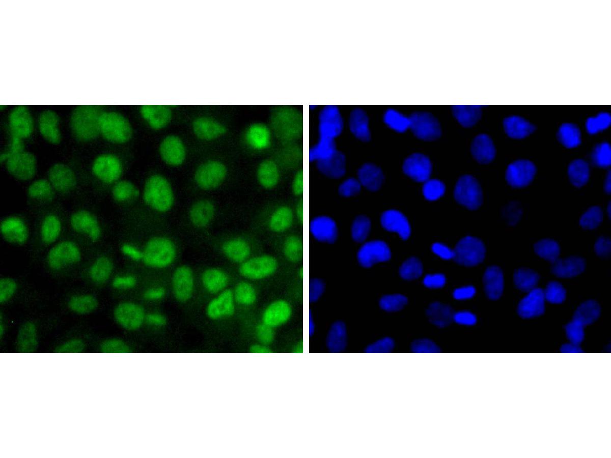 ICC staining of Phospho-SIRT1(T530) in 293 cells (green). Formalin fixed cells were permeabilized with 0.1% Triton X-100 in TBS for 10 minutes at room temperature and blocked with 1% Blocker BSA for 15 minutes at room temperature. Cells were probed with the primary antibody (ET1701-27, 1/50) for 1 hour at room temperature, washed with PBS. Alexa Fluor®488 Goat anti-Rabbit IgG was used as the secondary antibody at 1/1,000 dilution. The nuclear counter stain is DAPI (blue).