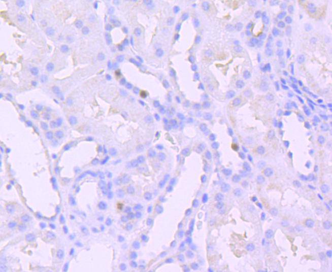 Immunohistochemical analysis of paraffin-embedded human kidney tissue using anti-Phospho-SIRT1(T530) antibody. The section was pre-treated using heat mediated antigen retrieval with Tris-EDTA buffer (pH 8.0-8.4) for 20 minutes.The tissues were blocked in 5% BSA for 30 minutes at room temperature, washed with ddH2O and PBS, and then probed with the primary antibody (ET1701-27, 1/50) for 30 minutes at room temperature. The detection was performed using an HRP conjugated compact polymer system. DAB was used as the chromogen. Tissues were counterstained with hematoxylin and mounted with DPX.