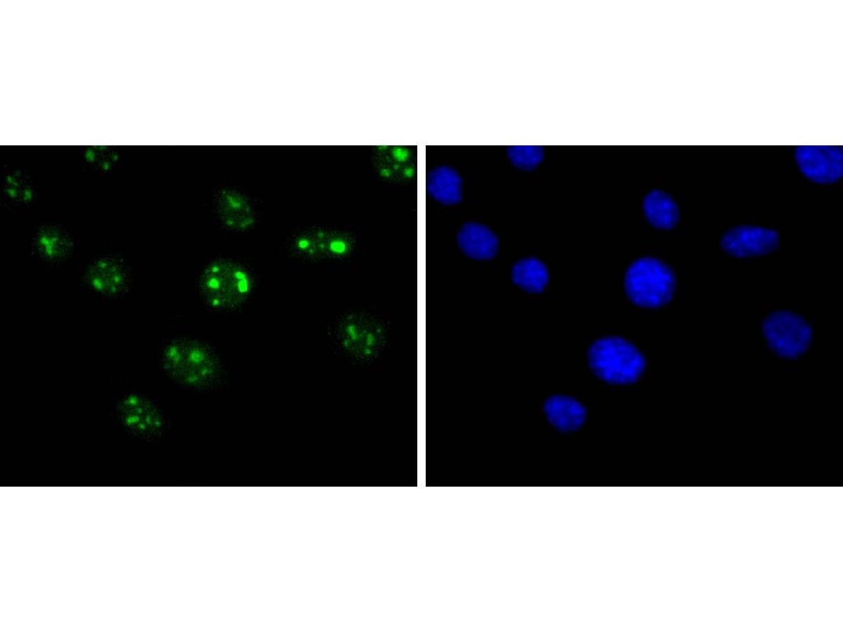 ICC staining of SIRT6 in NIH/3T3 cells (green). Formalin fixed cells were permeabilized with 0.1% Triton X-100 in TBS for 10 minutes at room temperature and blocked with 10% negative goat serum for 15 minutes at room temperature. Cells were probed with the primary antibody (ET1701-29, 1/50) for 1 hour at room temperature, washed with PBS. Alexa Fluor®488 conjugate-Goat anti-Rabbit IgG was used as the secondary antibody at 1/1,000 dilution. The nuclear counter stain is DAPI (blue).