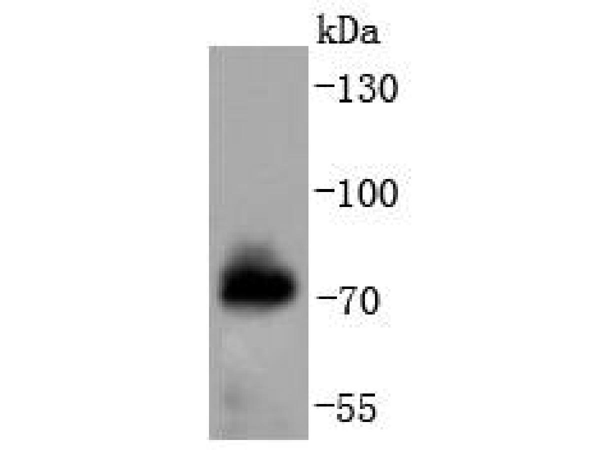 Western blot analysis of Phospho-Raf1(S621) on human skeletal muscle tissue lysates. Proteins were transferred to a PVDF membrane and blocked with 5% BSA in PBS for 1 hour at room temperature. The primary antibody (ET1701-3, 1/500) was used in 5% BSA at room temperature for 2 hours. Goat Anti-Rabbit IgG - HRP Secondary Antibody (HA1001) at 1:200,000 dilution was used for 1 hour at room temperature.