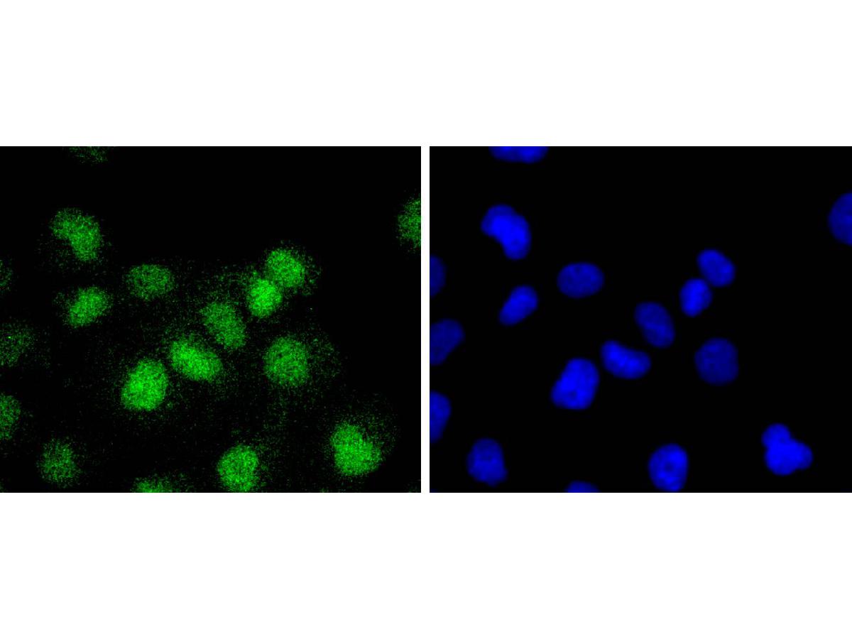 ICC staining ATF1 in Hela cells (green). The nuclear counter stain is DAPI (blue). Cells were fixed in paraformaldehyde, permeabilised with 0.25% Triton X100/PBS.