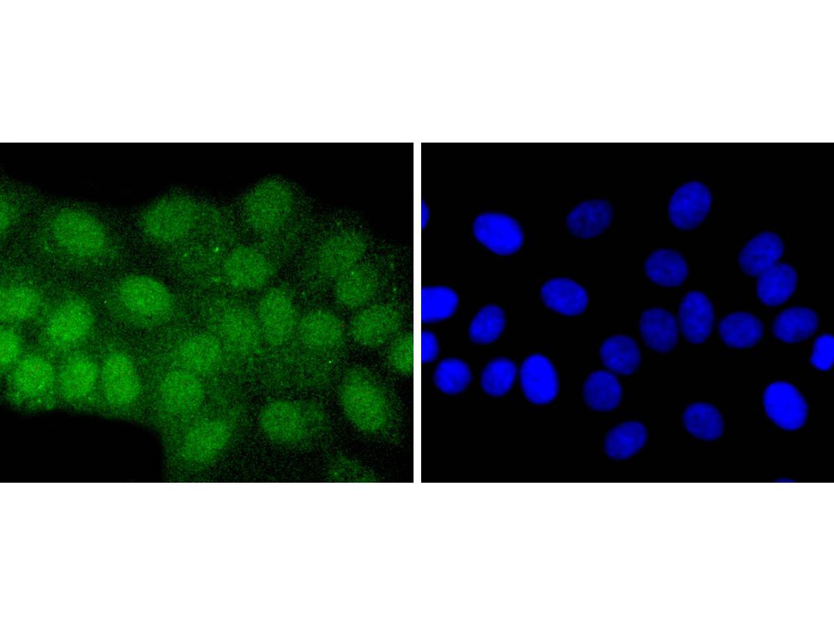 ICC staining ATF7 in HepG2 cells (green). The nuclear counter stain is DAPI (blue). Cells were fixed in paraformaldehyde, permeabilised with 0.25% Triton X100/PBS.