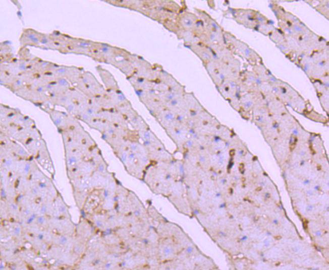 Immunohistochemical analysis of paraffin-embedded mouse heart tissue using anti-ATF7 antibody. Counter stained with hematoxylin.