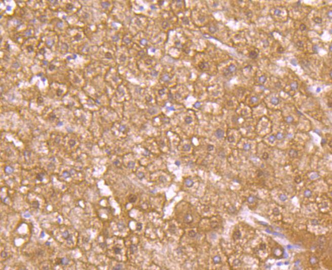 Immunohistochemical analysis of paraffin-embedded human liver tissue using anti-GLUT2 antibody. The section was pre-treated using heat mediated antigen retrieval with Tris-EDTA buffer (pH 9.0) for 20 minutes.The tissues were blocked in 5% BSA for 30 minutes at room temperature, washed with ddH2O and PBS, and then probed with the primary antibody (ET1701-34, 1/50) for 30 minutes at room temperature. The detection was performed using an HRP conjugated compact polymer system. DAB was used as the chromogen. Tissues were counterstained with hematoxylin and mounted with DPX.