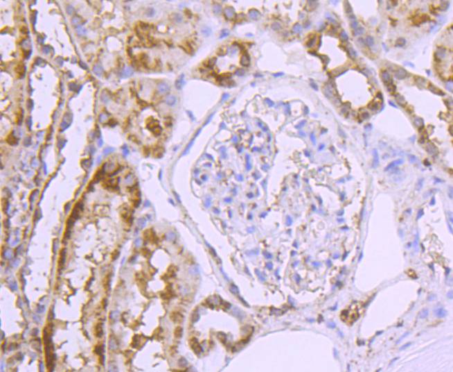 Immunohistochemical analysis of paraffin-embedded human kidney tissue using anti-GLUT2 antibody. The section was pre-treated using heat mediated antigen retrieval with Tris-EDTA buffer (pH 9.0) for 20 minutes.The tissues were blocked in 5% BSA for 30 minutes at room temperature, washed with ddH2O and PBS, and then probed with the primary antibody (ET1701-34, 1/50) for 30 minutes at room temperature. The detection was performed using an HRP conjugated compact polymer system. DAB was used as the chromogen. Tissues were counterstained with hematoxylin and mounted with DPX.