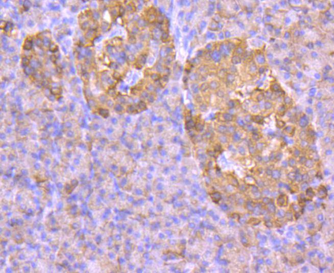 Immunohistochemical analysis of paraffin-embedded human pancreas tissue using anti-GLUT2 antibody. The section was pre-treated using heat mediated antigen retrieval with Tris-EDTA buffer (pH 9.0) for 20 minutes.The tissues were blocked in 5% BSA for 30 minutes at room temperature, washed with ddH2O and PBS, and then probed with the primary antibody (ET1701-34, 1/50) for 30 minutes at room temperature. The detection was performed using an HRP conjugated compact polymer system. DAB was used as the chromogen. Tissues were counterstained with hematoxylin and mounted with DPX.