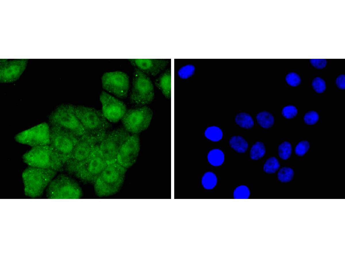 ICC staining of Phospho-JunD(S255) in HepG2 cells (green). Formalin fixed cells were permeabilized with 0.1% Triton X-100 in TBS for 10 minutes at room temperature and blocked with 10% negative goat serum for 15 minutes at room temperature. Cells were probed with the primary antibody (ET1701-35, 1/50) for 1 hour at room temperature, washed with PBS. Alexa Fluor®488 conjugate-Goat anti-Rabbit IgG was used as the secondary antibody at 1/1,000 dilution. The nuclear counter stain is DAPI (blue).