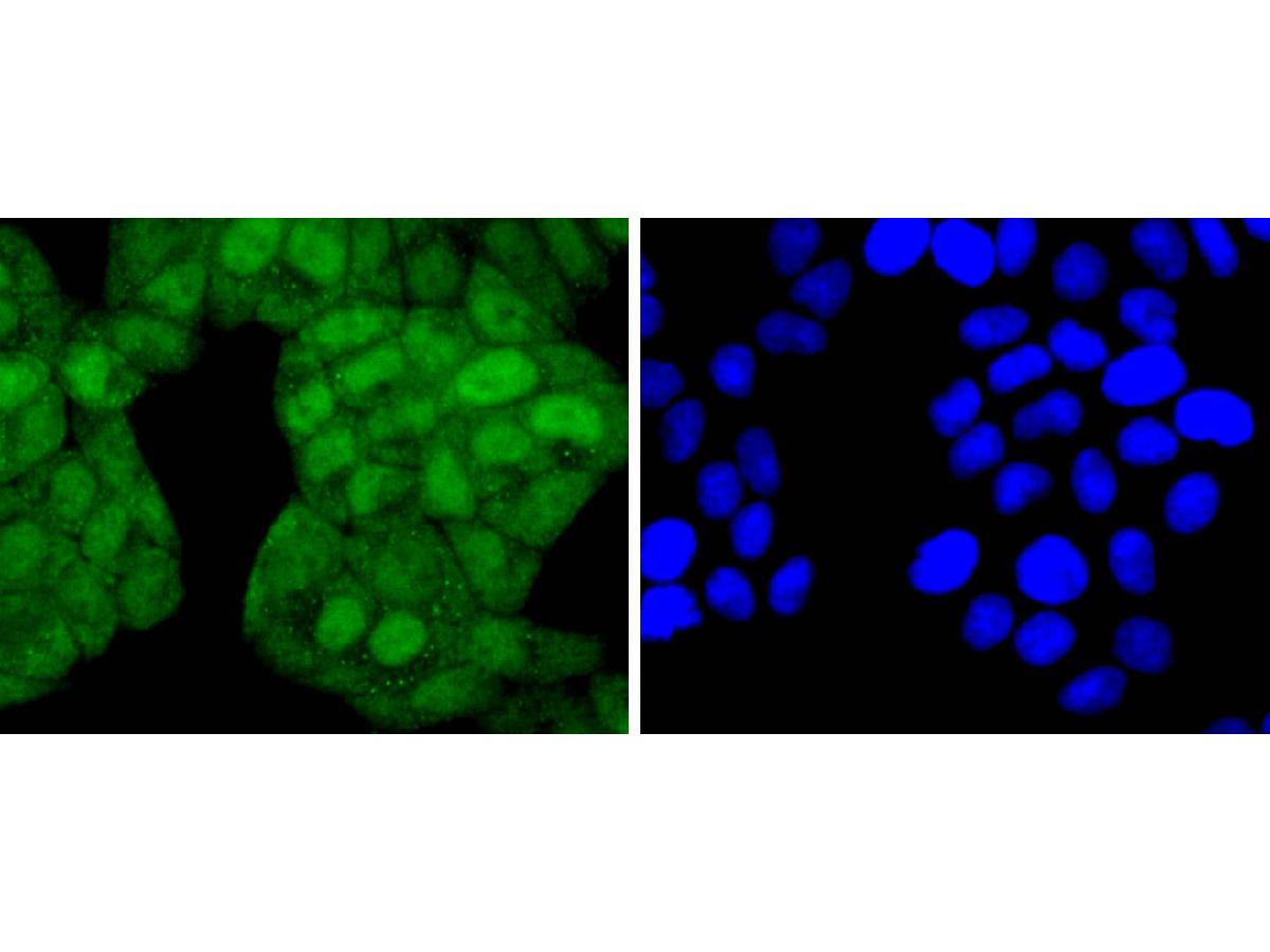 ICC staining of Phospho-JunD(S255) in Hela cells (green). Formalin fixed cells were permeabilized with 0.1% Triton X-100 in TBS for 10 minutes at room temperature and blocked with 10% negative goat serum for 15 minutes at room temperature. Cells were probed with the primary antibody (ET1701-35, 1/50) for 1 hour at room temperature, washed with PBS. Alexa Fluor®488 conjugate-Goat anti-Rabbit IgG was used as the secondary antibody at 1/1,000 dilution. The nuclear counter stain is DAPI (blue).