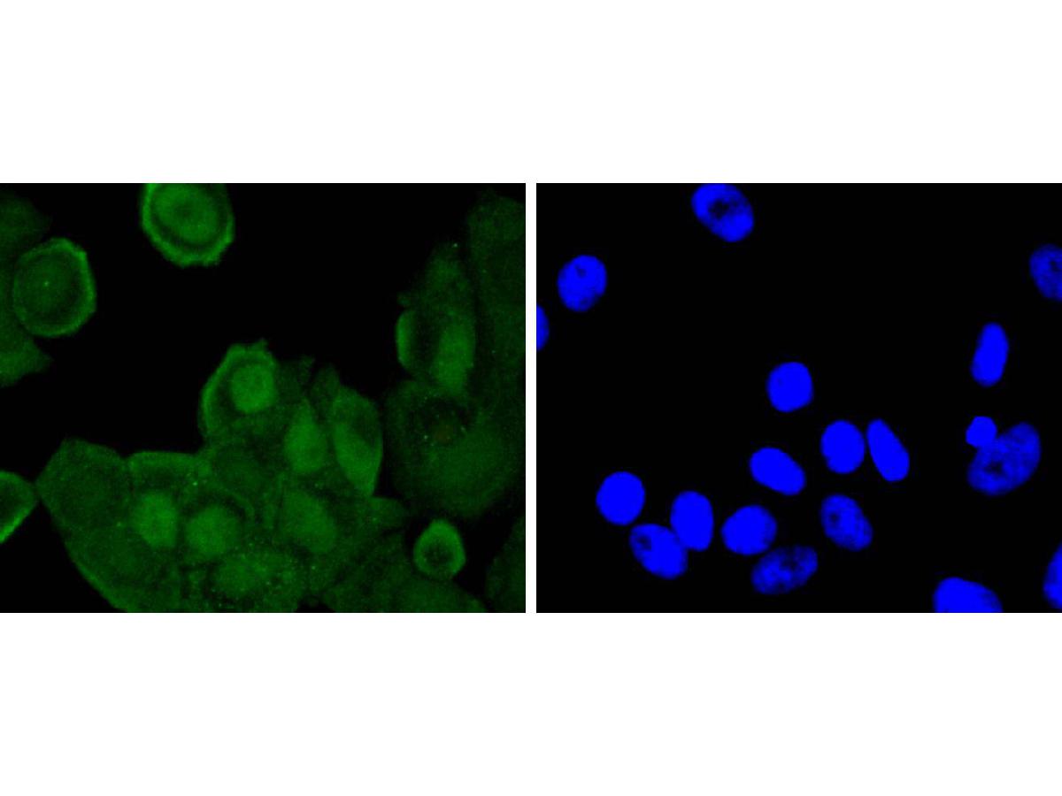 ICC staining of Phospho-JunD(S255) in MCF-7 cells (green). Formalin fixed cells were permeabilized with 0.1% Triton X-100 in TBS for 10 minutes at room temperature and blocked with 10% negative goat serum for 15 minutes at room temperature. Cells were probed with the primary antibody (ET1701-35, 1/50) for 1 hour at room temperature, washed with PBS. Alexa Fluor®488 conjugate-Goat anti-Rabbit IgG was used as the secondary antibody at 1/1,000 dilution. The nuclear counter stain is DAPI (blue).