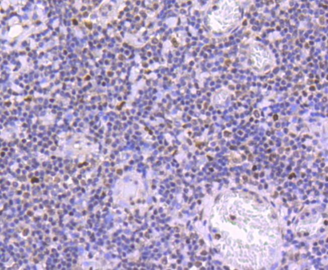 Immunohistochemical analysis of paraffin-embedded human tonsil tissue using anti-Phospho-JunD(S255) antibody. The section was pre-treated using heat mediated antigen retrieval with Tris-EDTA buffer (pH 9.0) for 20 minutes.The tissues were blocked in 1% BSA for 30 minutes at room temperature, washed with ddH2O and PBS, and then probed with the primary antibody (ET1701-35, 1/50) for 30 minutes at room temperature. The detection was performed using an HRP conjugated compact polymer system. DAB was used as the chromogen. Tissues were counterstained with hematoxylin and mounted with DPX.