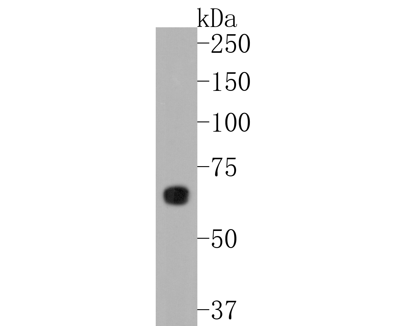 Western blot analysis of Phospho-AMPK alpha 2(S345) on 293 cell lysates. Proteins were transferred to a PVDF membrane and blocked with 5% BSA in PBS for 1 hour at room temperature. The primary antibody (ET1701-37, 1/500) was used in 5% BSA at room temperature for 2 hours. Goat Anti-Rabbit IgG - HRP Secondary Antibody (HA1001) at 1:200,000 dilution was used for 1 hour at room temperature.