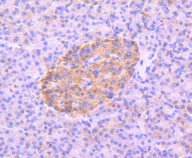 Immunohistochemical analysis of paraffin-embedded human pancreas tissue using anti-Phospho-AMPK alpha 2(S345) antibody. The section was pre-treated using heat mediated antigen retrieval with Tris-EDTA buffer (pH 8.0-8.4) for 20 minutes.The tissues were blocked in 5% BSA for 30 minutes at room temperature, washed with ddH2O and PBS, and then probed with the primary antibody (ET1701-37, 1/50) for 30 minutes at room temperature. The detection was performed using an HRP conjugated compact polymer system. DAB was used as the chromogen. Tissues were counterstained with hematoxylin and mounted with DPX.