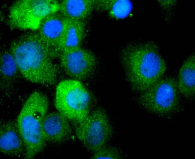 ICC staining of IL1 beta in Hela cells (green). Formalin fixed cells were permeabilized with 0.1% Triton X-100 in TBS for 10 minutes at room temperature and blocked with 1% Blocker BSA for 15 minutes at room temperature. Cells were probed with the primary antibody (ET1701-39, 1/50) for 1 hour at room temperature, washed with PBS. Alexa Fluor®488 Goat anti-Rabbit IgG was used as the secondary antibody at 1/1,000 dilution. The nuclear counter stain is DAPI (blue).