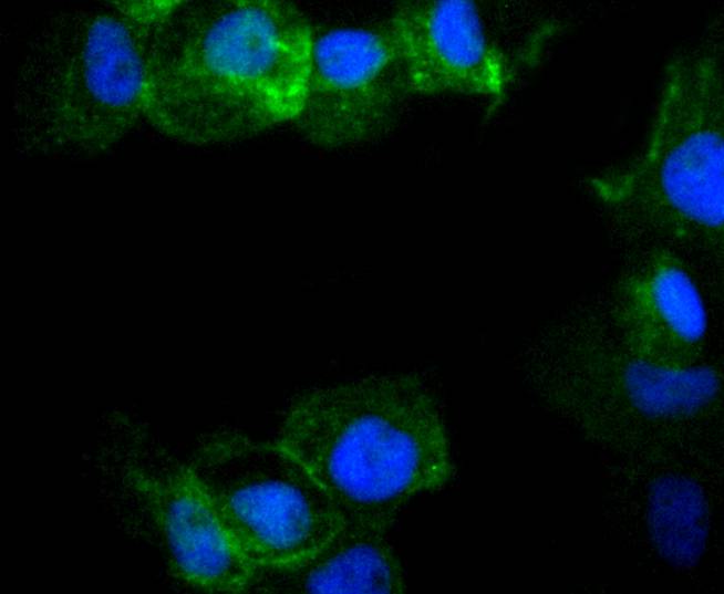 ICC staining of Phospho-Rac1+Cdc42(Ser71) in A431 cells (green). Formalin fixed cells were permeabilized with 0.1% Triton X-100 in TBS for 10 minutes at room temperature and blocked with 1% Blocker BSA for 15 minutes at room temperature. Cells were probed with the primary antibody (ET1701-40, 1/50) for 1 hour at room temperature, washed with PBS. Alexa Fluor®488 Goat anti-Rabbit IgG was used as the secondary antibody at 1/1,000 dilution. The nuclear counter stain is DAPI (blue).