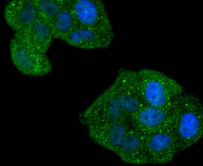 ICC staining of Phospho-Rac1+Cdc42(Ser71) in Hela cells (green). Formalin fixed cells were permeabilized with 0.1% Triton X-100 in TBS for 10 minutes at room temperature and blocked with 1% Blocker BSA for 15 minutes at room temperature. Cells were probed with the primary antibody (ET1701-40, 1/50) for 1 hour at room temperature, washed with PBS. Alexa Fluor®488 Goat anti-Rabbit IgG was used as the secondary antibody at 1/1,000 dilution. The nuclear counter stain is DAPI (blue).