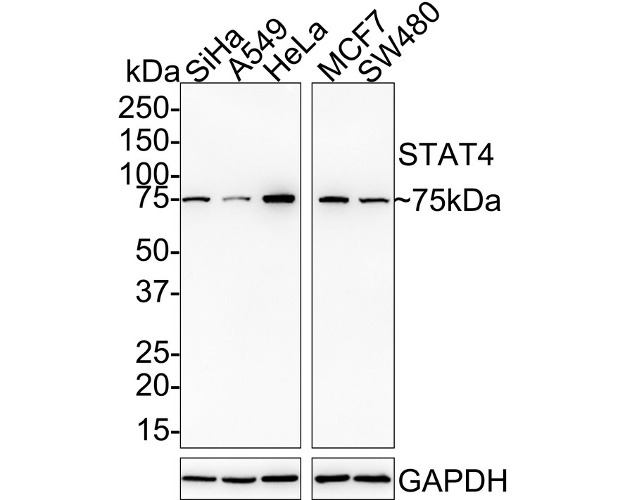 Western blot analysis of STAT4 on Daudi cell lysates. Proteins were transferred to a PVDF membrane and blocked with 5% BSA in PBS for 1 hour at room temperature. The primary antibody (ET1701-42, 1/500) was used in 5% BSA at room temperature for 2 hours. Goat Anti-Rabbit IgG - HRP Secondary Antibody (HA1001) at 1:200,000 dilution was used for 1 hour at room temperature.