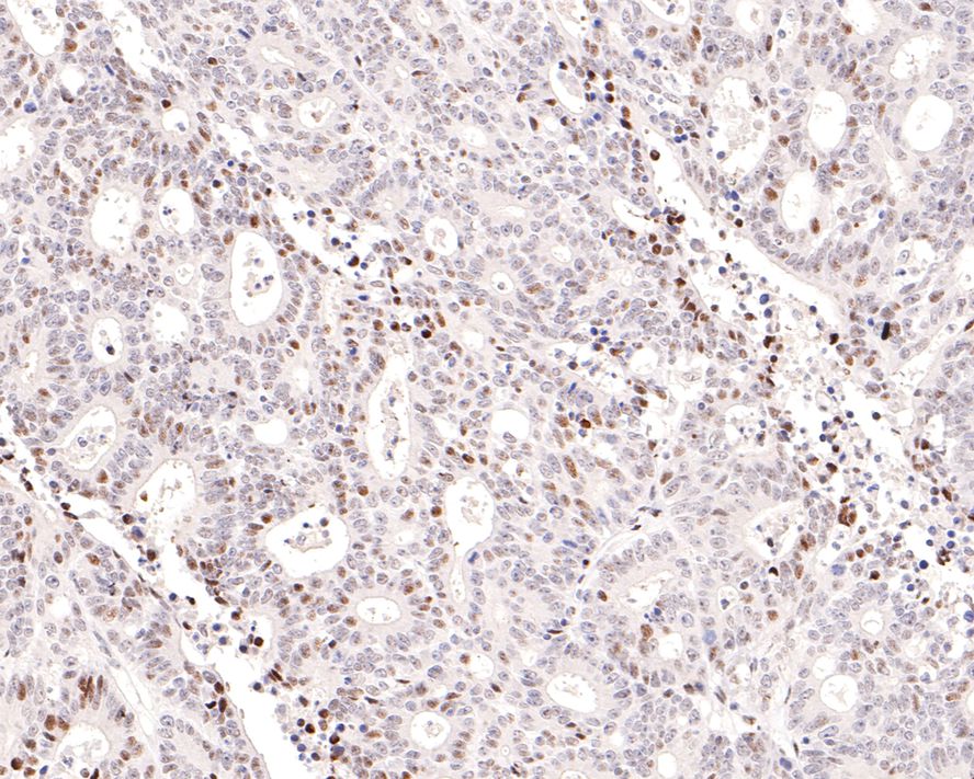 ICC staining of STAT4 in MCF-7 cells (green). Formalin fixed cells were permeabilized with 0.1% Triton X-100 in TBS for 10 minutes at room temperature and blocked with 10% negative goat serum for 15 minutes at room temperature. Cells were probed with the primary antibody (ET1701-42, 1/50) for 1 hour at room temperature, washed with PBS. Alexa Fluor®488 conjugate-Goat anti-Rabbit IgG was used as the secondary antibody at 1/1,000 dilution. The nuclear counter stain is DAPI (blue).