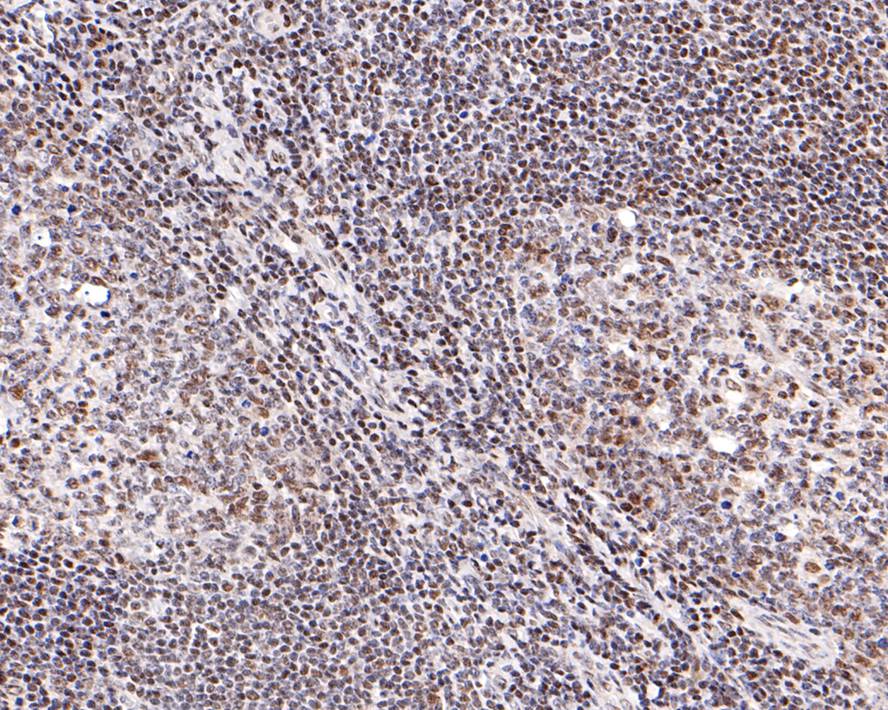 ICC staining of STAT4 in SW480 cells (green). Formalin fixed cells were permeabilized with 0.1% Triton X-100 in TBS for 10 minutes at room temperature and blocked with 10% negative goat serum for 15 minutes at room temperature. Cells were probed with the primary antibody (ET1701-42, 1/50) for 1 hour at room temperature, washed with PBS. Alexa Fluor®488 conjugate-Goat anti-Rabbit IgG was used as the secondary antibody at 1/1,000 dilution. The nuclear counter stain is DAPI (blue).