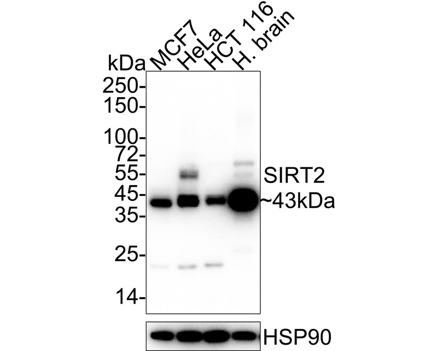 Western blot analysis of SIRT2 on human brain tissue lysates. Proteins were transferred to a PVDF membrane and blocked with 5% BSA in PBS for 1 hour at room temperature. The primary antibody (ET1701-43, 1/500) was used in 5% BSA at room temperature for 2 hours. Goat Anti-Rabbit IgG - HRP Secondary Antibody (HA1001) at 1:200,000 dilution was used for 1 hour at room temperature.
