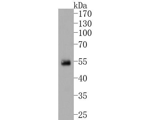 Western blot analysis of IRF2 on human lung tissue lysates. Proteins were transferred to a PVDF membrane and blocked with 5% BSA in PBS for 1 hour at room temperature. The primary antibody (ET1701-44, 1/500) was used in 5% BSA at room temperature for 2 hours. Goat Anti-Rabbit IgG - HRP Secondary Antibody (HA1001) at 1:5,000 dilution was used for 1 hour at room temperature.