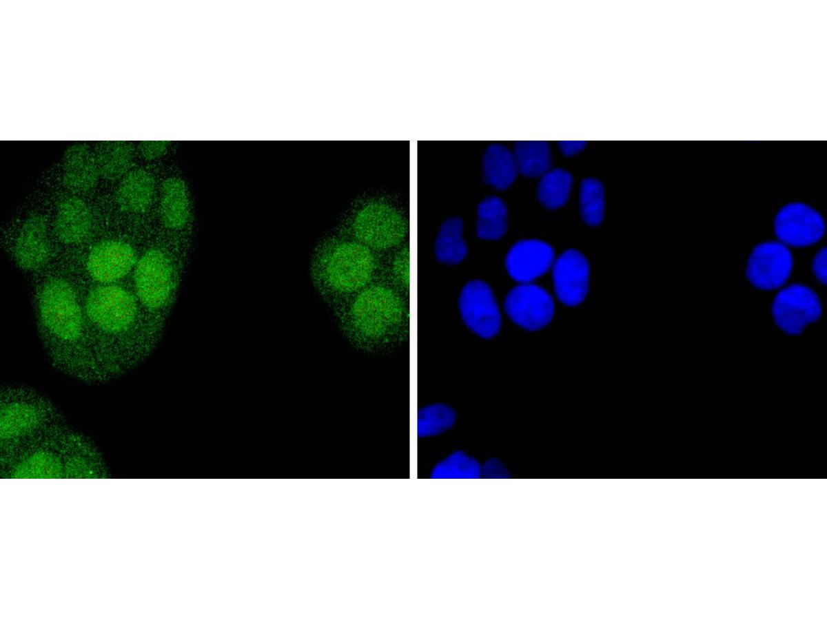 ICC staining of IRF2 in Hela cells (green). Formalin fixed cells were permeabilized with 0.1% Triton X-100 in TBS for 10 minutes at room temperature and blocked with 1% Blocker BSA for 15 minutes at room temperature. Cells were probed with the primary antibody (ET1701-44, 1/50) for 1 hour at room temperature, washed with PBS. Alexa Fluor®488 Goat anti-Rabbit IgG was used as the secondary antibody at 1/1,000 dilution. The nuclear counter stain is DAPI (blue).
