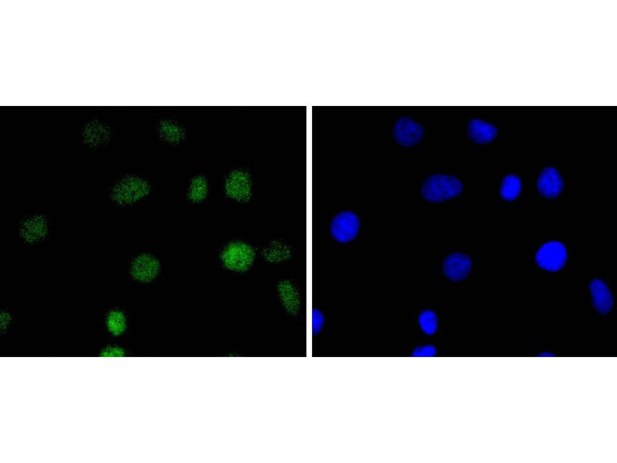 ICC staining of IRF2 in A549 cells (green). Formalin fixed cells were permeabilized with 0.1% Triton X-100 in TBS for 10 minutes at room temperature and blocked with 1% Blocker BSA for 15 minutes at room temperature. Cells were probed with the primary antibody (ET1701-44, 1/50) for 1 hour at room temperature, washed with PBS. Alexa Fluor®488 Goat anti-Rabbit IgG was used as the secondary antibody at 1/1,000 dilution. The nuclear counter stain is DAPI (blue).