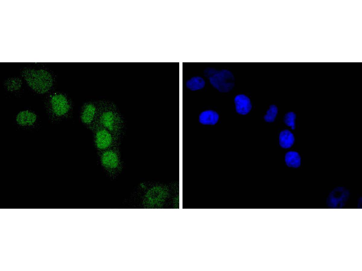 ICC staining of IRF2 in PANC-1 cells (green). Formalin fixed cells were permeabilized with 0.1% Triton X-100 in TBS for 10 minutes at room temperature and blocked with 1% Blocker BSA for 15 minutes at room temperature. Cells were probed with the primary antibody (ET1701-44, 1/50) for 1 hour at room temperature, washed with PBS. Alexa Fluor®488 Goat anti-Rabbit IgG was used as the secondary antibody at 1/1,000 dilution. The nuclear counter stain is DAPI (blue).