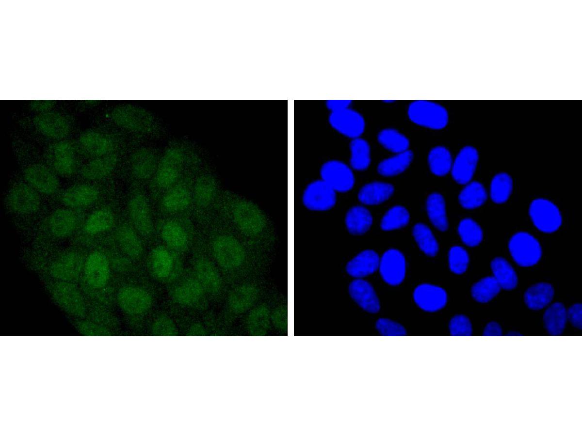 ICC staining of STAT 5A+B in HepG2 cells (green). Formalin fixed cells were permeabilized with 0.1% Triton X-100 in TBS for 10 minutes at room temperature and blocked with 1% Blocker BSA for 15 minutes at room temperature. Cells were probed with the primary antibody (ET1701-45, 1/50) for 1 hour at room temperature, washed with PBS. Alexa Fluor®488 Goat anti-Rabbit IgG was used as the secondary antibody at 1/1,000 dilution. The nuclear counter stain is DAPI (blue).